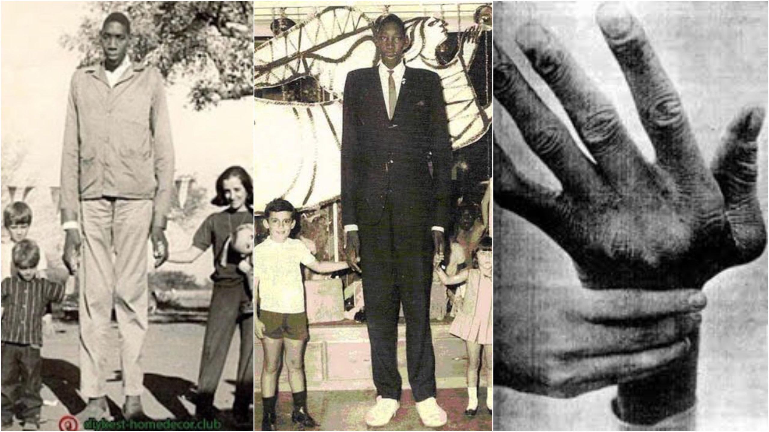 The tallest African descent in the recorded history. John Rogan 8 ft 9 in (2m 67cm)