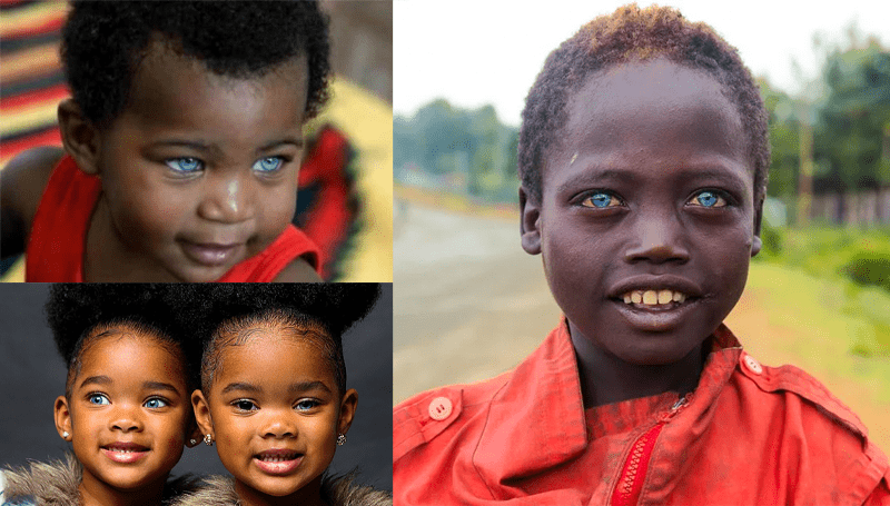 Untold facts behind black Africans with blue eyes